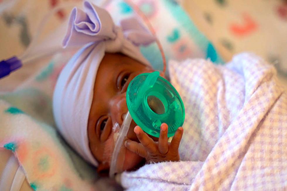 This March, 2019 photo provided by Sharp HealthCare in San Diego shows a baby named Saybie. Sha ...