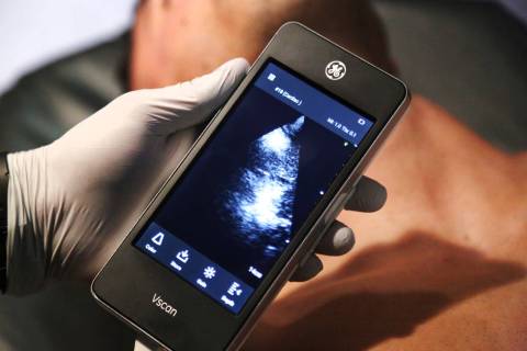 Jessica Bryce holds a portable ultrasound machine showing ultrasound scan image of paramedic st ...