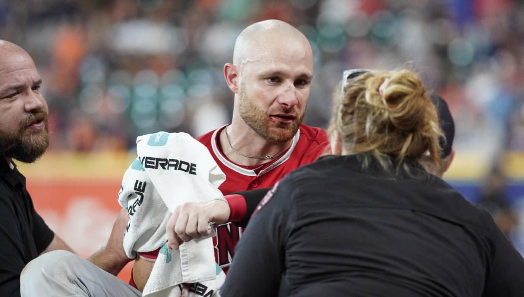 Los Angeles Angels' Jonathan Lucroy, center, is carted off the field after colliding with Houst ...