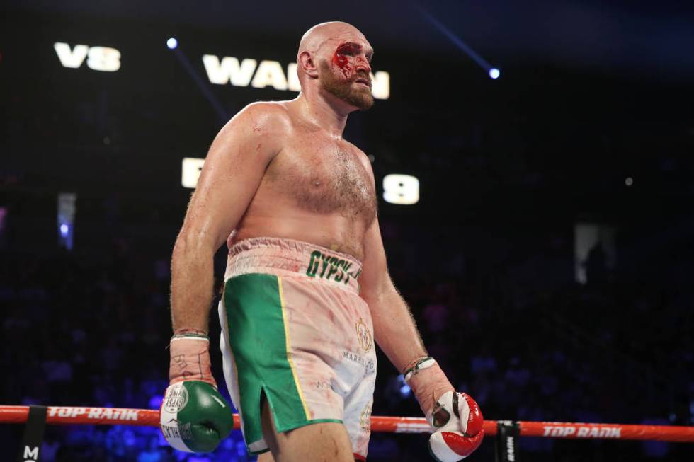 Tyson Fury walks to his corner after the ninth round against Otto Wallin in the heavyweight bou ...