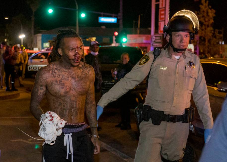 Las Vegas Police officers escort a bloodied protester from a Black Lives Matter march about Con ...