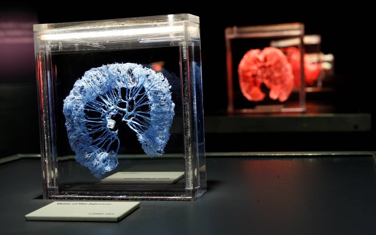 A gallery of circulatory displays is shown at "Bodies ... The Exhibition" at Luxor. (Premier Ex ...