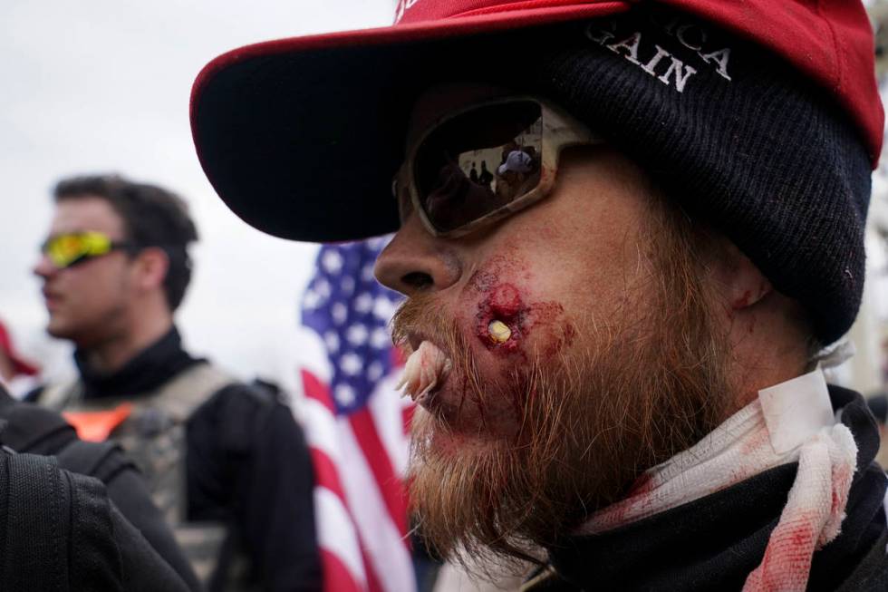 A protestor is shown injured during a confrontation with police during a rally Wednesday, Jan. ...