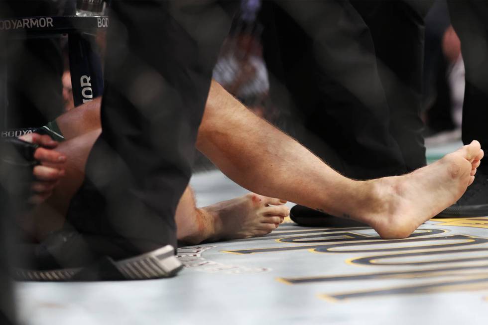 Conor McGregor receives assistance after hurting his foot in the first round of a lightweight b ...