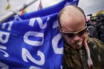 A protestor is shown injured during a confrontation with police during a rally Wednesday, Jan. ...