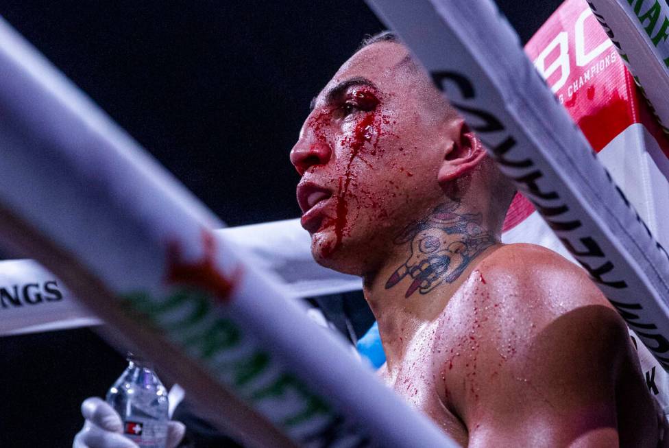 Mario Barrios sits bleeding after the eighth round versus Keith Thurman during their Welterweig ...