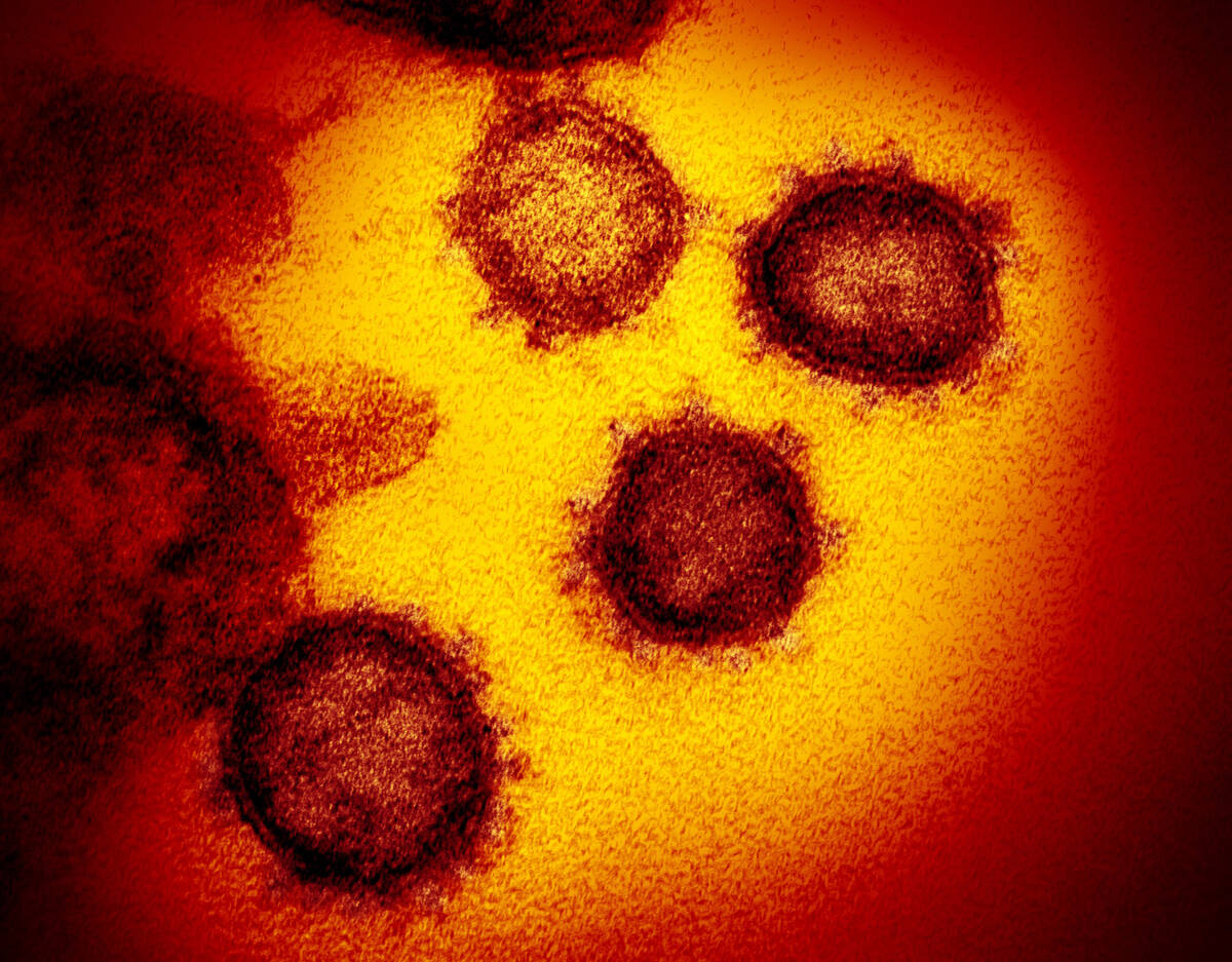 An image from an electron microscope shows SARS-CoV-2, the virus that causes COVID-19. (NIAID-R ...