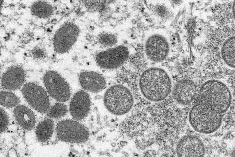 FILE - This 2003 electron microscope image made available by the Centers for Disease Control an ...
