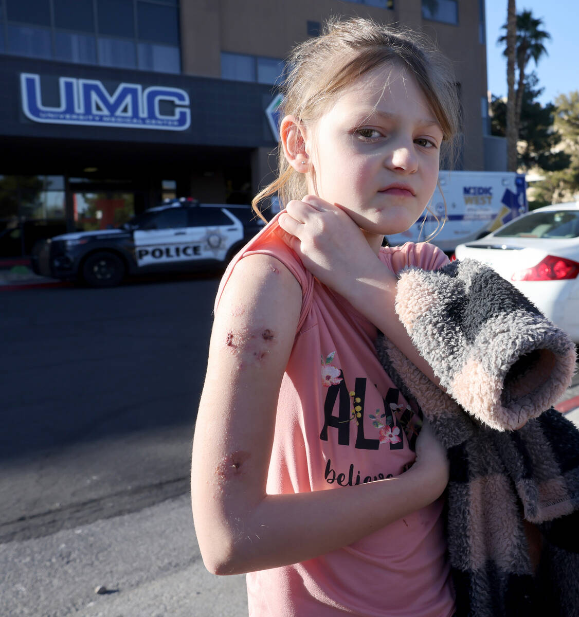 Paige Woodworth, 8, shows where metal rods were inserted in her arm before a medical appointmen ...