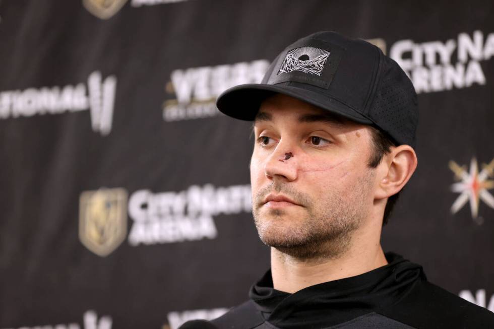 Vegas Golden Knights defenseman Alec Martinez talks about the 2021-22 season during a news conf ...