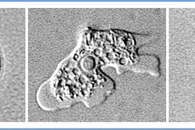 The image provided by the Center for Disease Control shows the Naegleria fowleri amoeba in the ...