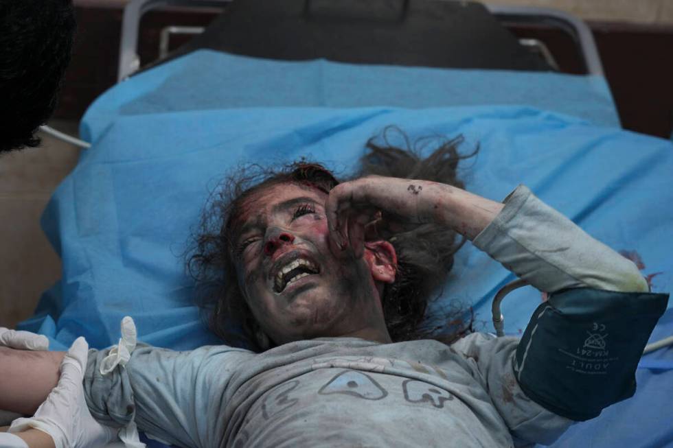 A Palestinian girl, wounded in Israeli bombardment on Gaza Strip, cries in a hospital in Deir a ...