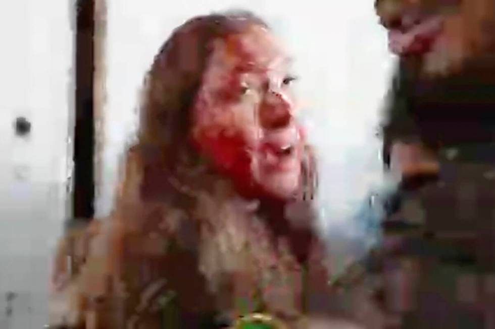 This image taken from video provided by the Hostage Families Forum, shows a bloodied Israeli fe ...