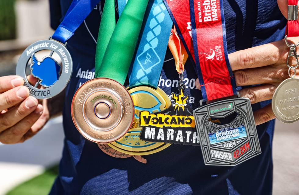 Derek Stefureac wears some of the medals he has earned from marathons. Despite being diagnosed ...