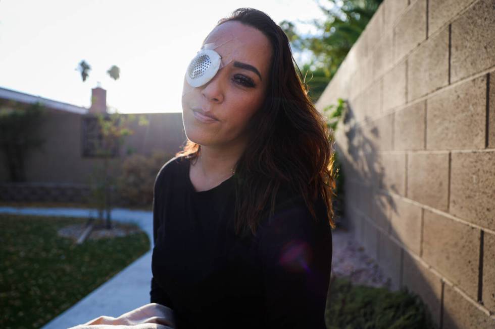 Martha Carbajal, who said she was shot while driving after making a wrong turn, poses for a por ...