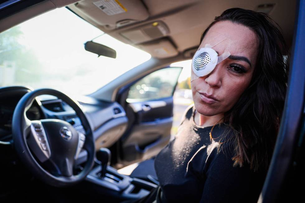 Martha Carbajal, who said she was shot while driving after making a wrong turn, poses for a por ...