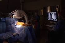 Surgeon Kevin Debiparshad works on a leg lengthening surgery for an 18-year-old patient at Sunr ...